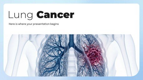 Plantilla de presentación Cáncer de pulmón