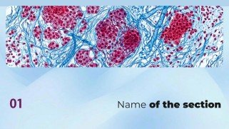 Plantilla de presentación Cáncer de pulmón