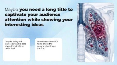 Plantilla de presentación Cáncer de pulmón