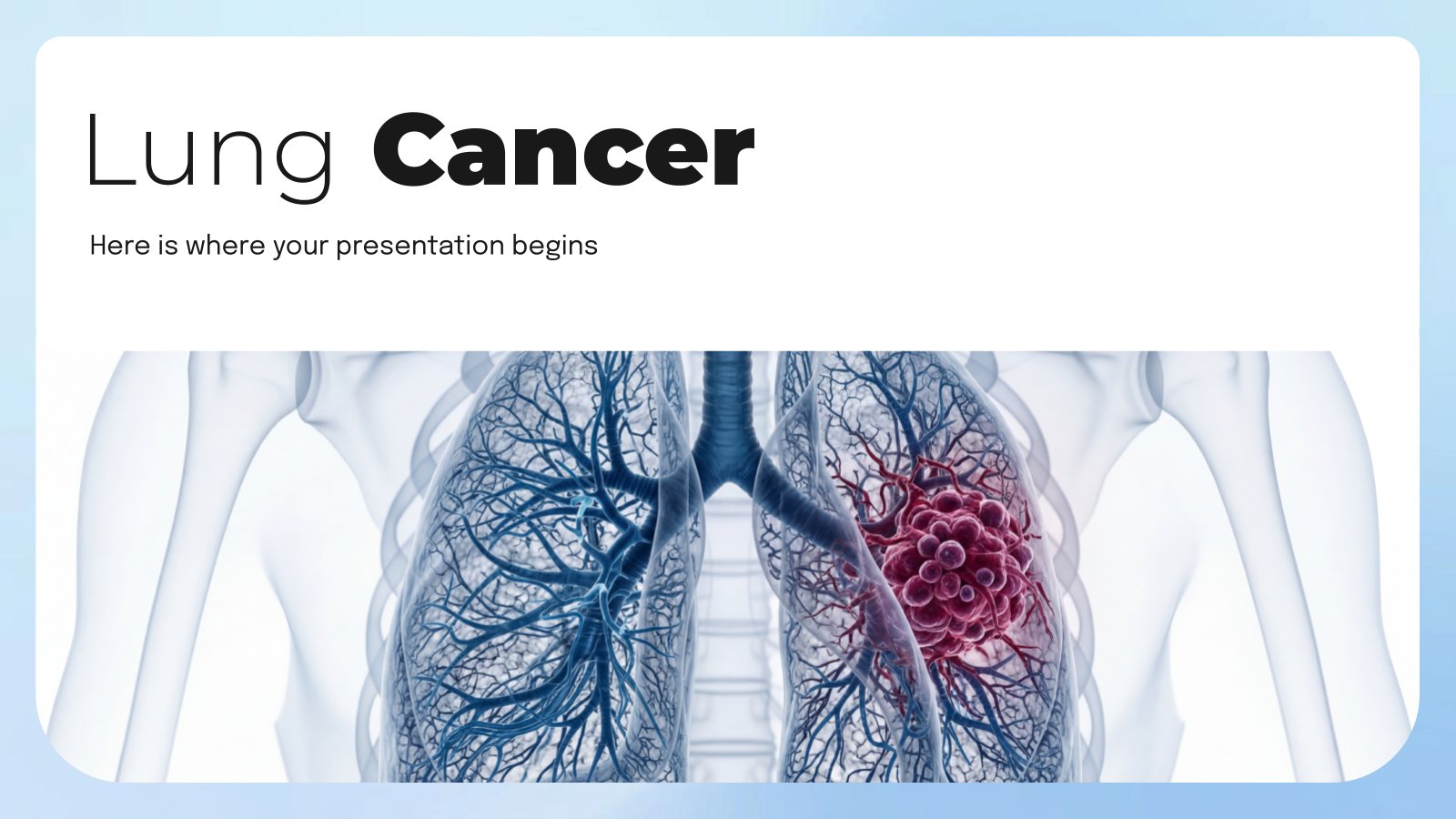 Plantilla de presentación Cáncer de pulmón