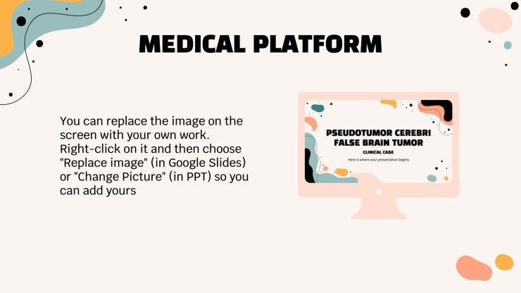 Pseudotumor Cerebri (Fake Brain Tumor) Clinical Case presentation template 