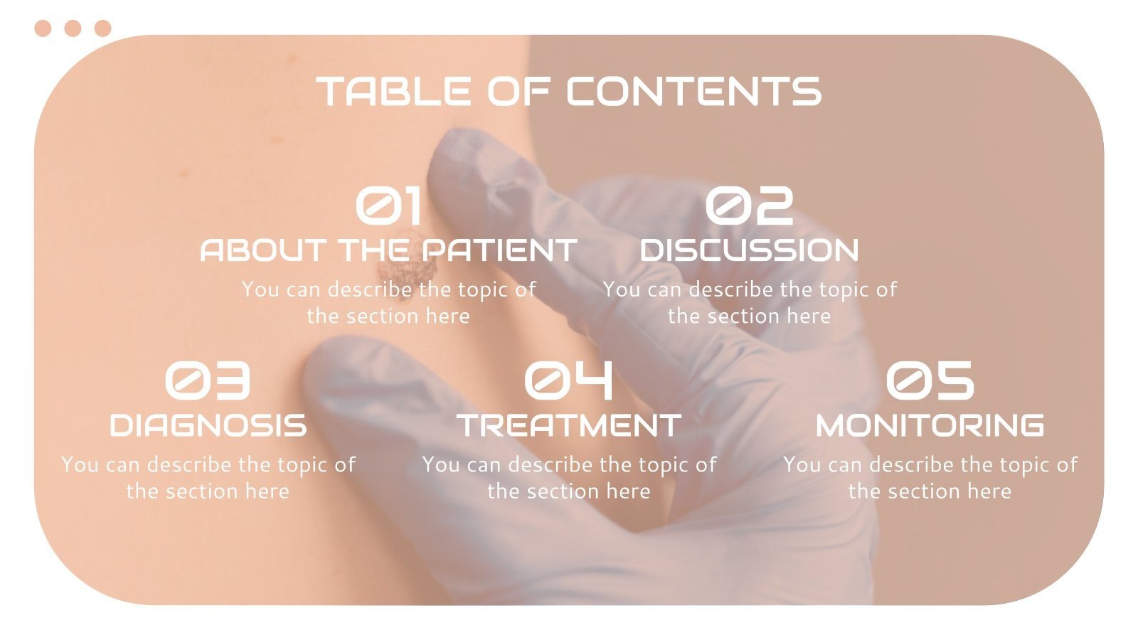Skin Cancer or Melanoma Case Study Google Slides & PPT