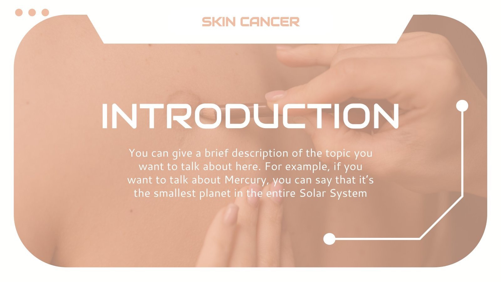 Skin Cancer or Melanoma Case Study Google Slides & PPT