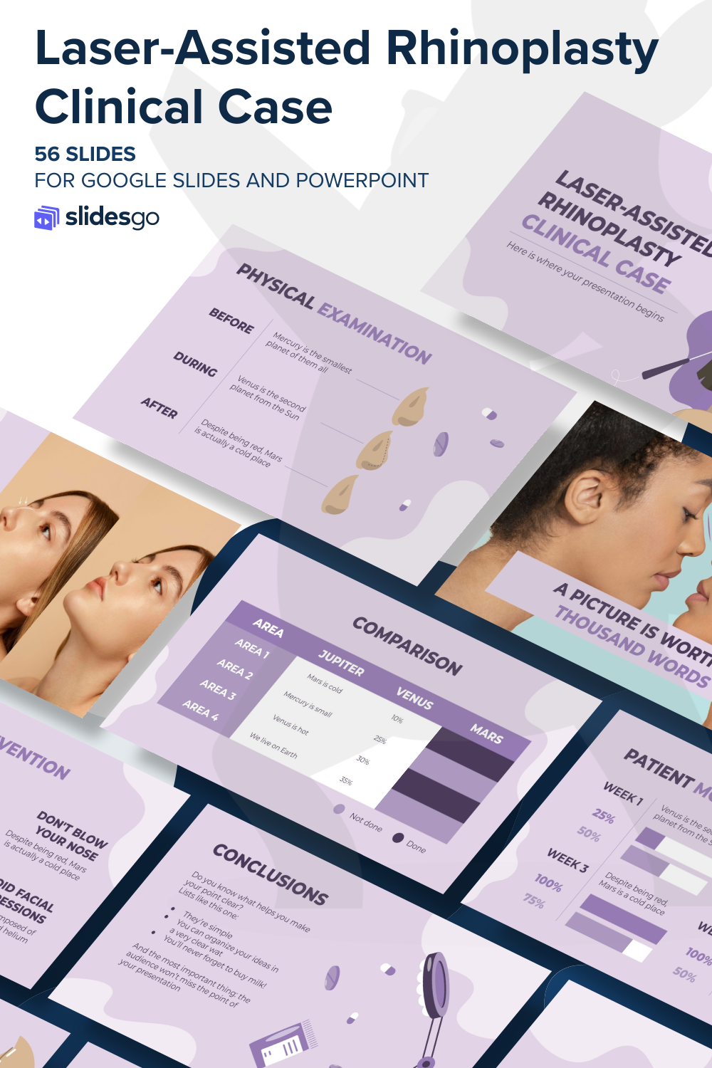 Laser-Assisted Rhinoplasty Clinical Case | Google Slides