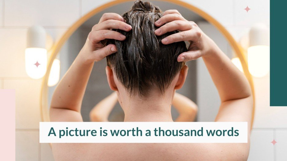 Hair Care Routine for Dandruff Case Report