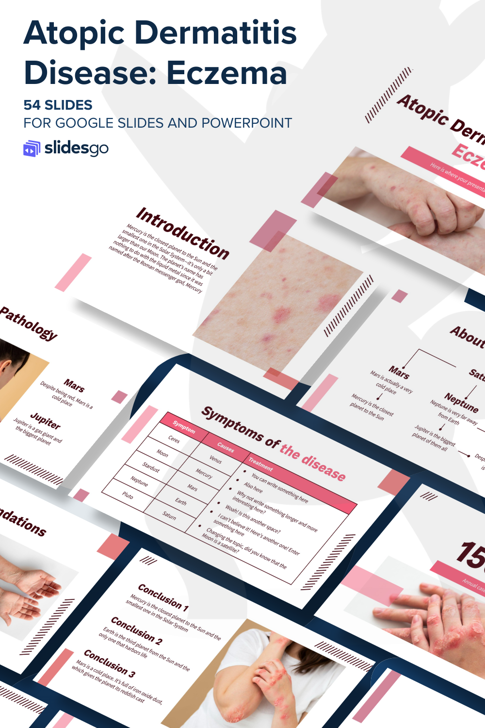 Atopic Dermatitis Disease: Eczema | Google Slides & PPT