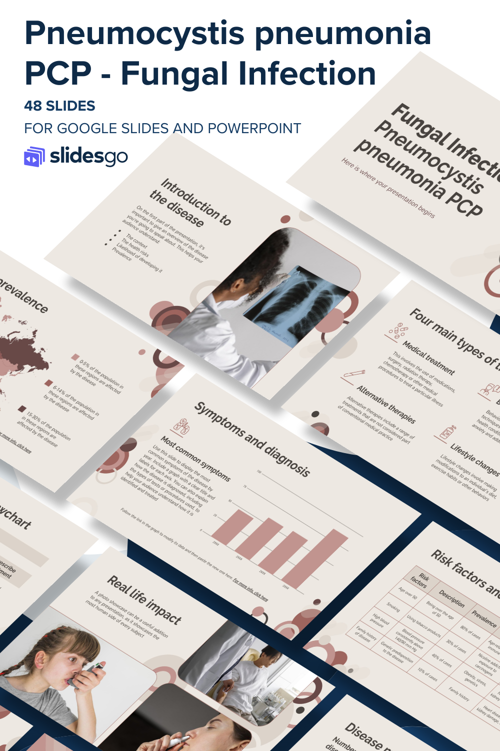 Fungal Infection Pneumocystis Pneumonia PCP