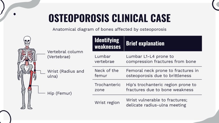 Modelo de apresentação Infográficos para relato de caso sobre osteoporose