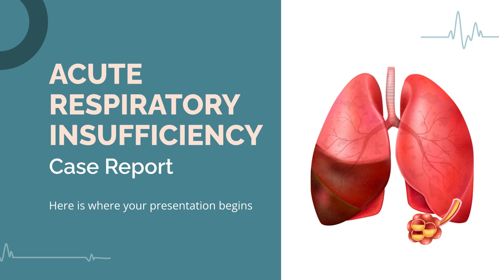 Acute Respiratory Insufficiency Case Report presentation template 