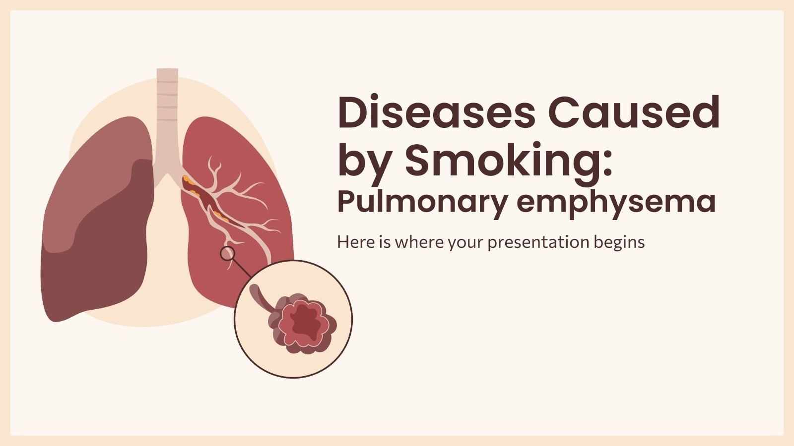Maladies causées par le tabagisme Emphysème pulmonaire