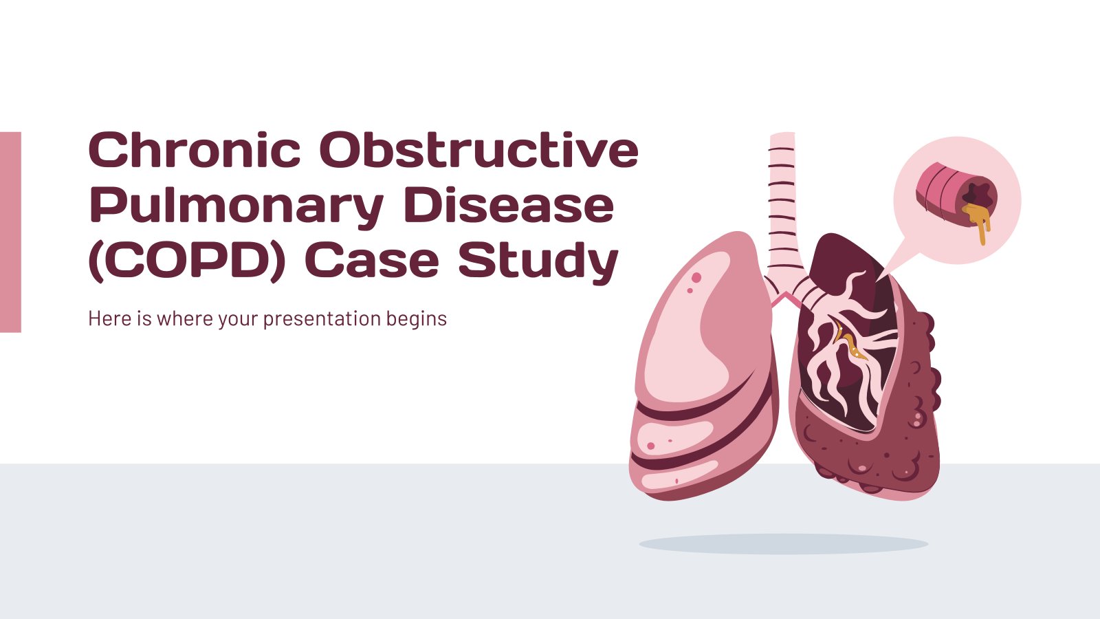 Fallstudie: Chronisch obstruktive Lungenerkrankung (COPD) Präsentationsvorlage