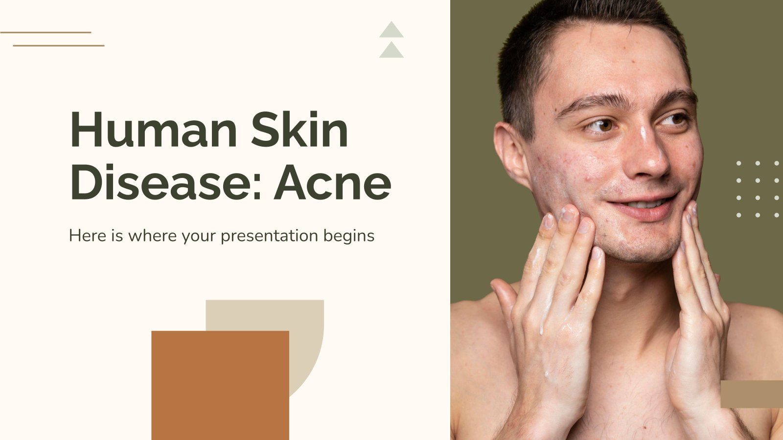 Modelo de apresentação Doença de pele: Acne