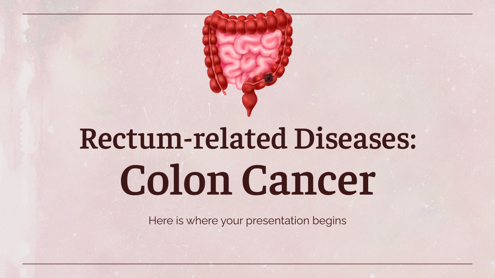 Rectum-related Diseases: Colon Cancer presentation template 