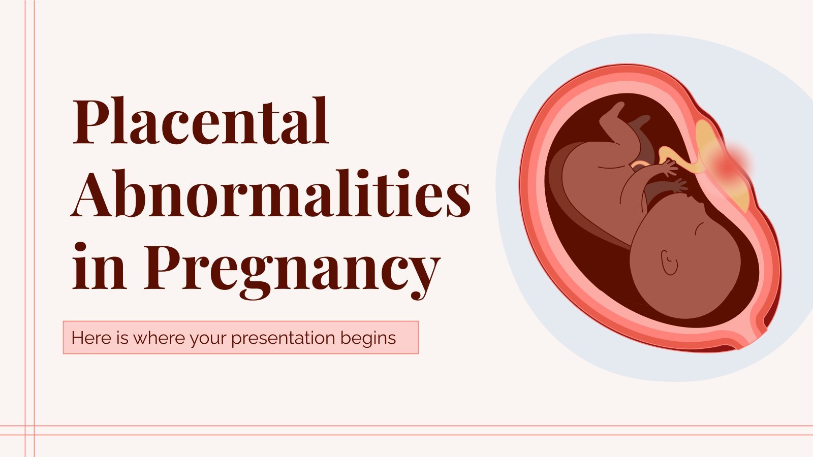 Placental Abnormalities in Pregnancy presentation template 