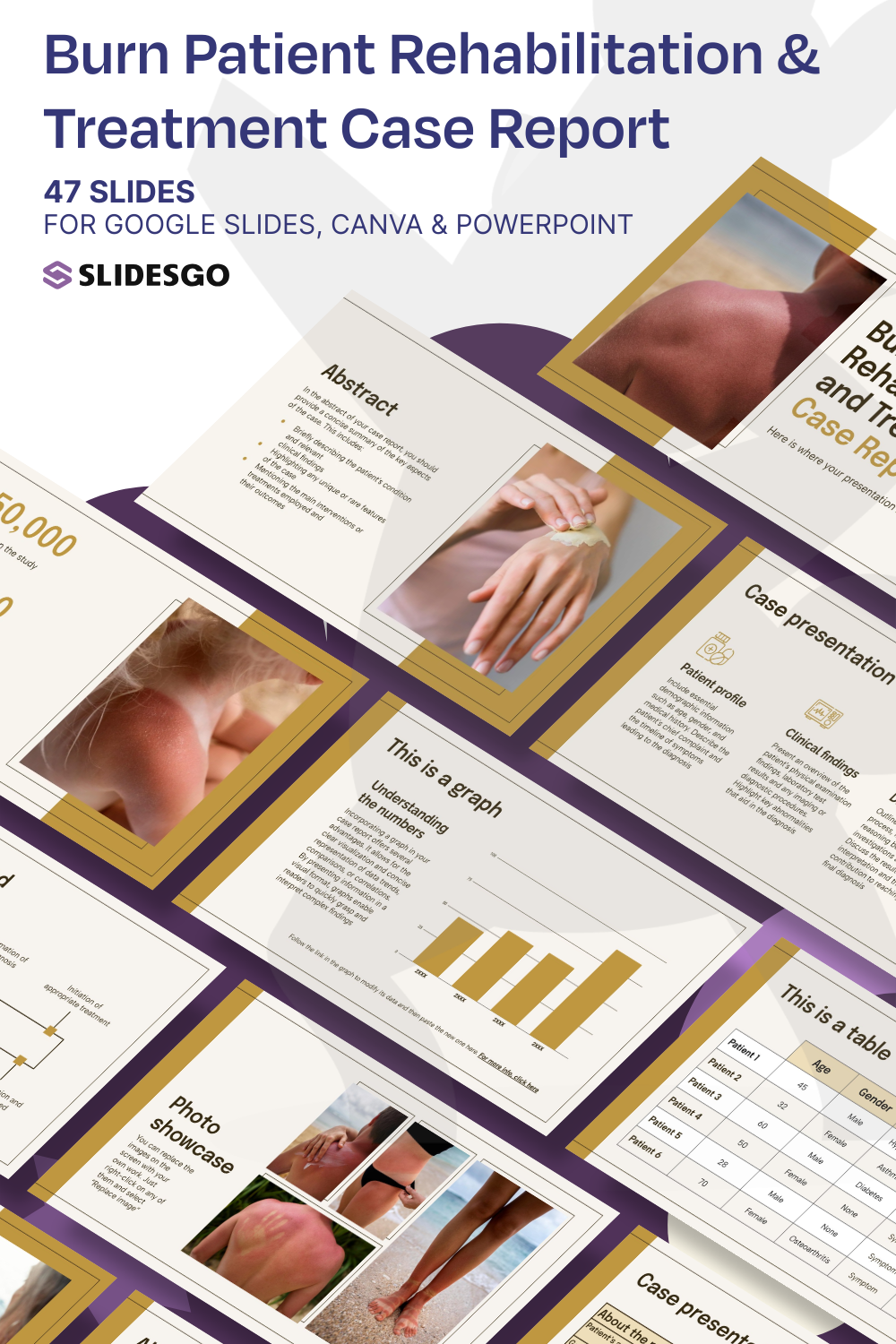 Burn Patient Rehabilitation and Treatment Case Report Presentation