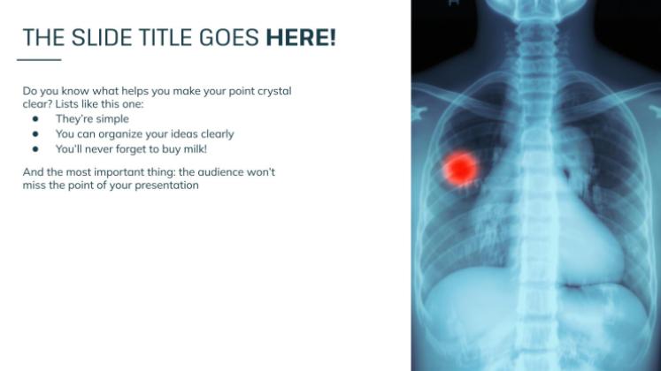 Modelo de apresentação Dia Mundial do Câncer de Pulmão