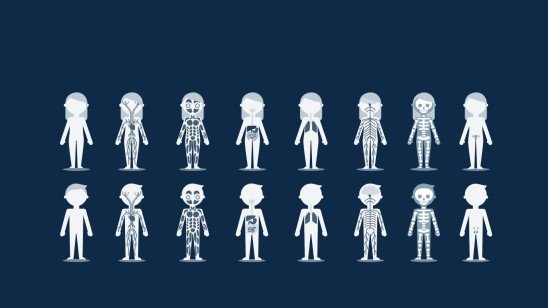 Cas clinique en neurologie Modèles de présentation