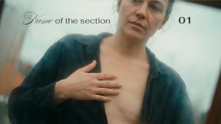 Plantilla de presentación Cáncer de mama