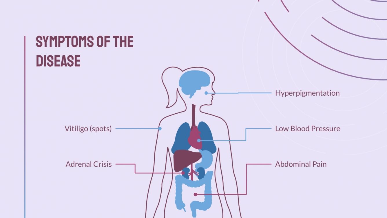 Doença de Addison | Modelo do Google Slides e PowerPoint